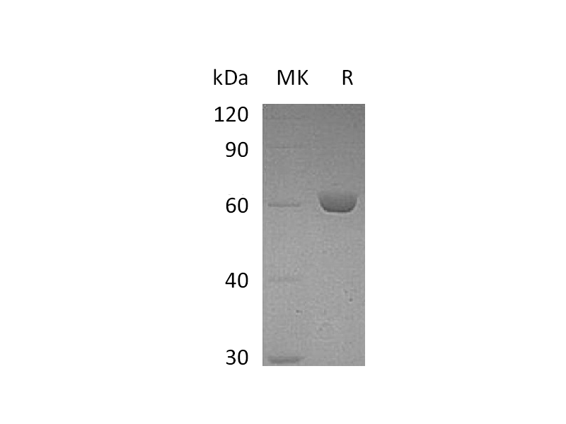 Recombinant Mouse CES2E (C-6His)