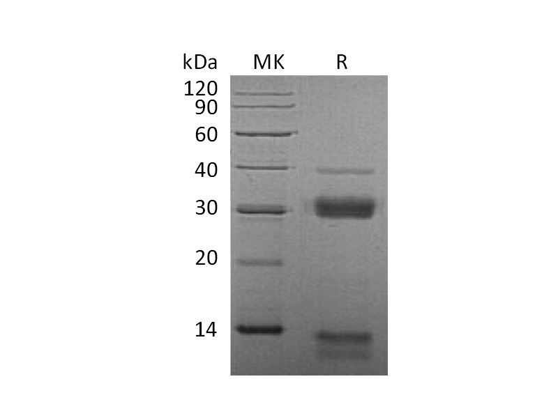 Recombinant Mouse CTSS (C-6His)
