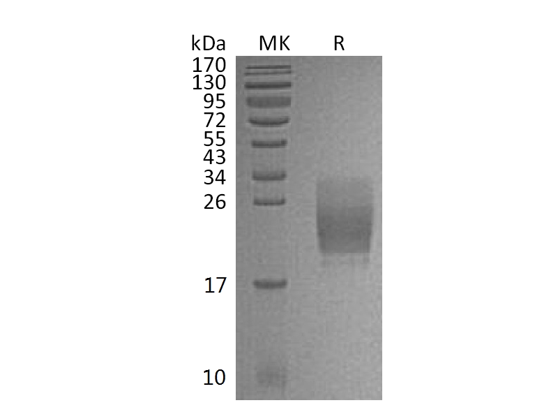 Recombinant Mouse CD160 (C-6His)