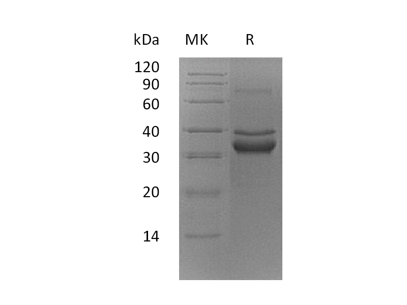 Recombinant Mouse TWEAK R (C-Fc)