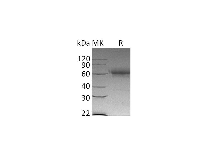 Recombinant Mouse CD27 (C-Fc-6His)