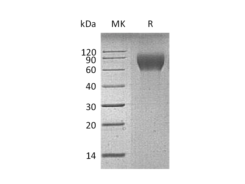 Recombinant Mouse CD6 (C-6His)