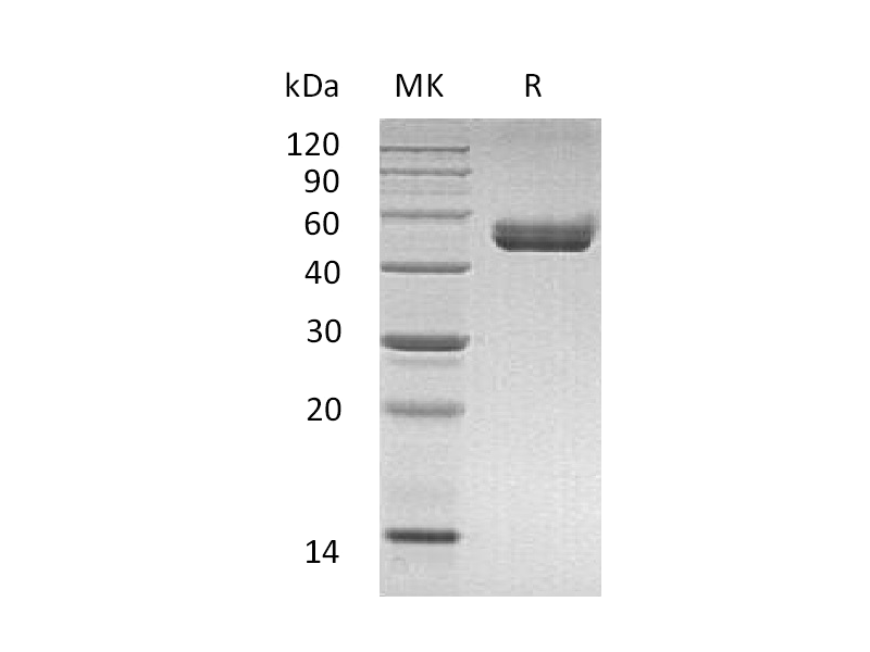 Recombinant Mouse CD74 (C-mFc-6His)