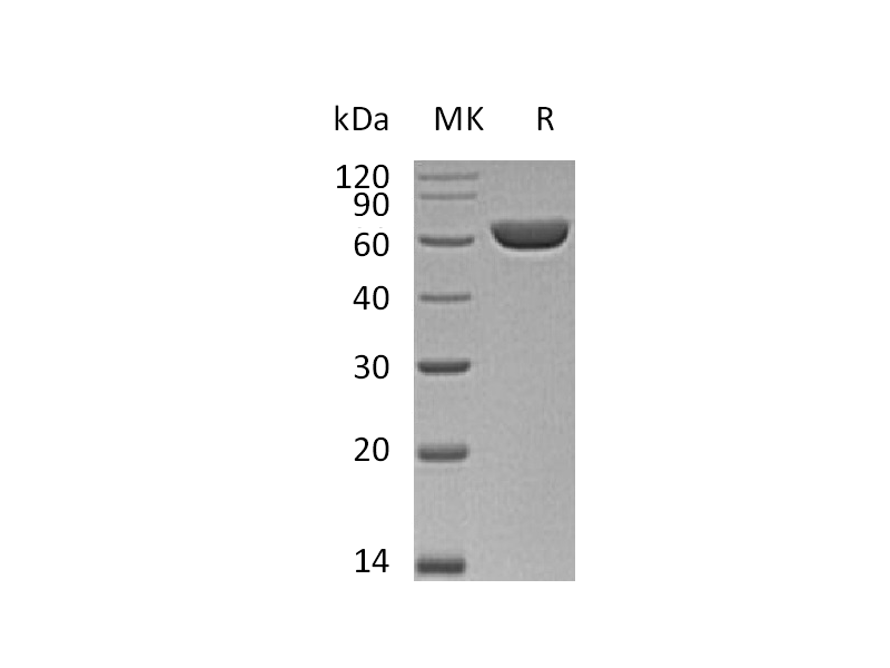 Recombinant Mouse CES3 (C-6His)