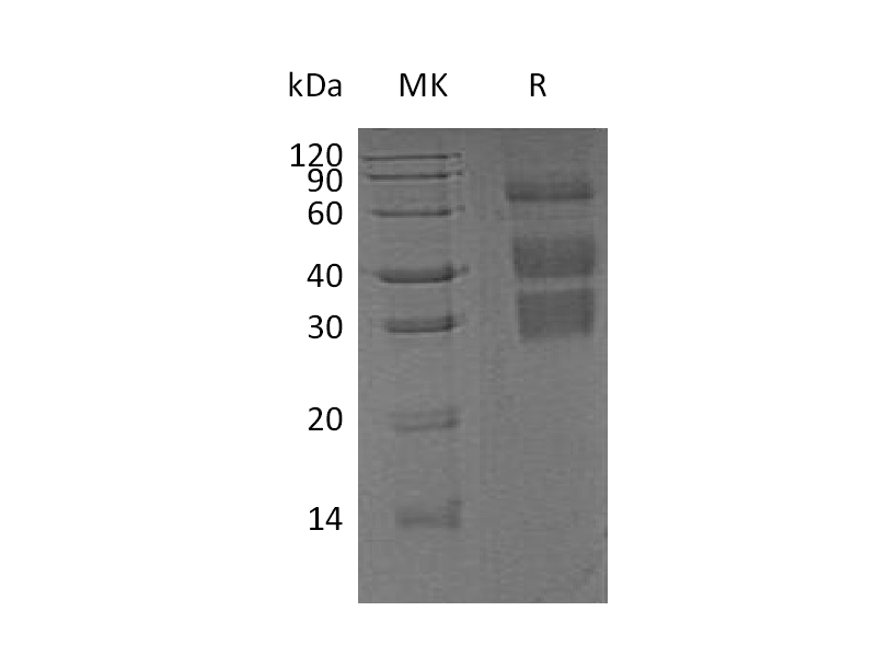 Recombinant Mouse Clusterin (C-6His)