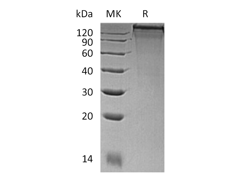 Recombinant Mouse COL3A1 (C-6His)