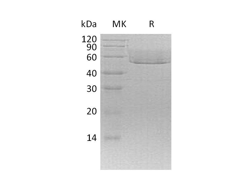 Recombinant Mouse CX3CL1 (C-6His)
