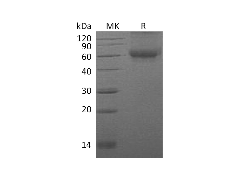Recombinant Mouse DDR2 (C-6His)