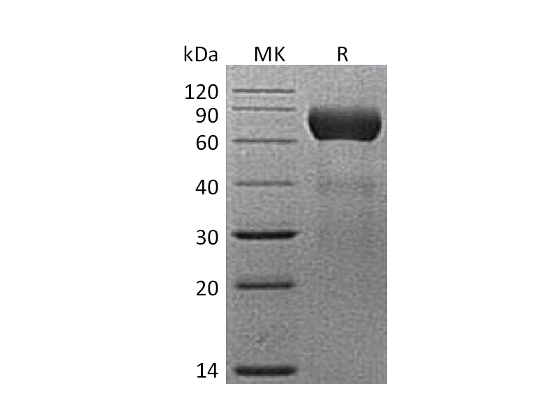 Recombinant Mouse CD39L1 (C-6His)