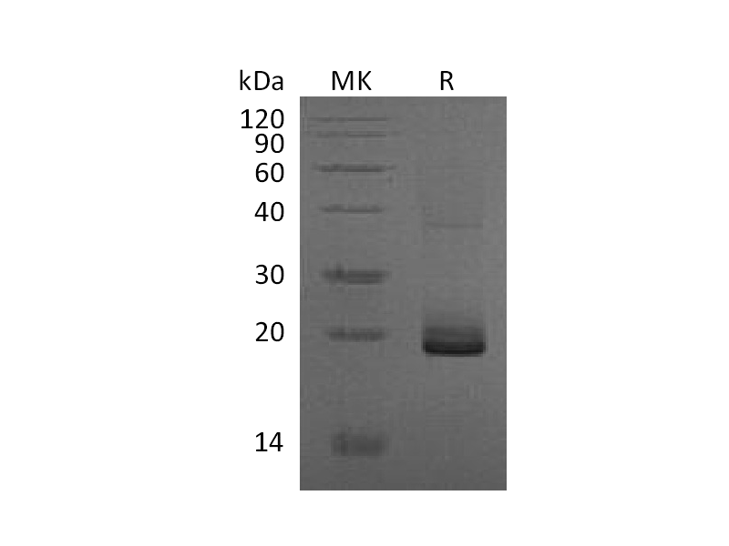Recombinant Mouse ESM‑1 (C-6His)