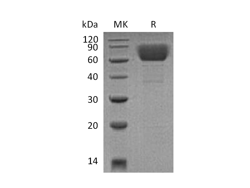 Recombinant Mouse CD39 (C-6His)