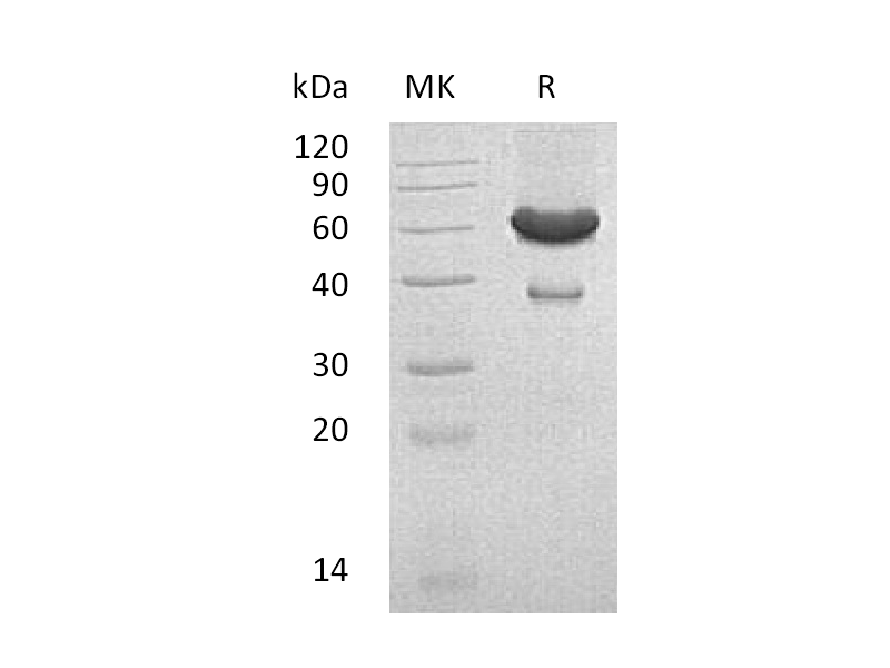 Recombinant Mouse EFNA1 (C-Fc-6His)