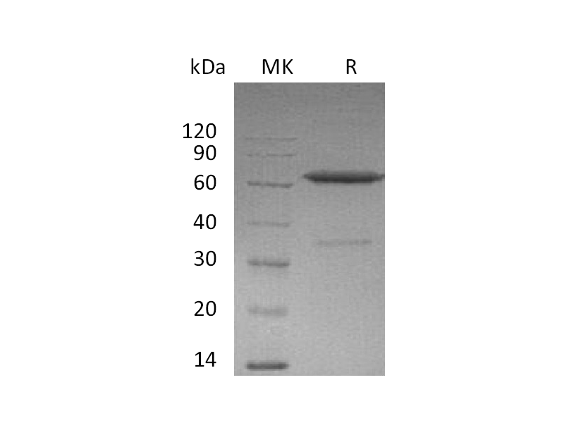 Recombinant Mouse EFNA3 (C-Fc)