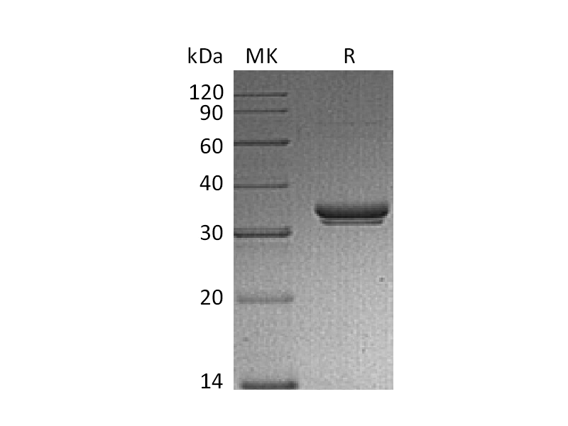 Recombinant Mouse EXTL2 (N-6His)
