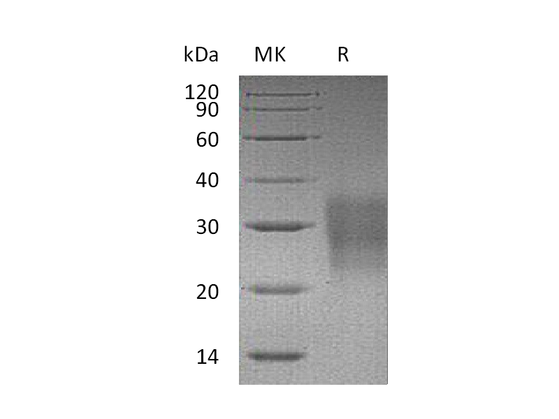 Recombinant Mouse Fas (C-6His)