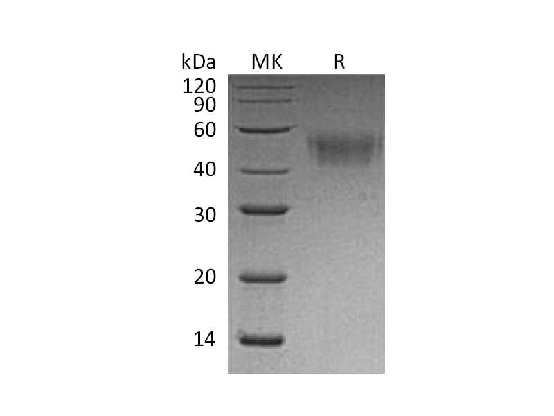 Recombinant Mouse CD64 (C-6His)