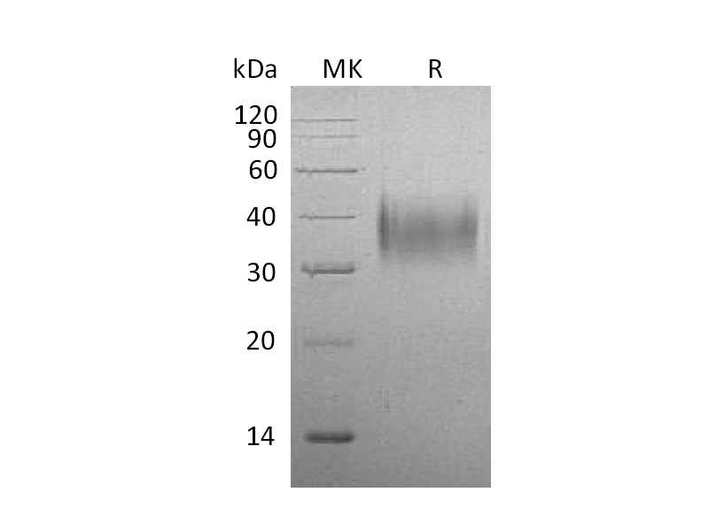 Recombinant Mouse CD16 (C-6His)