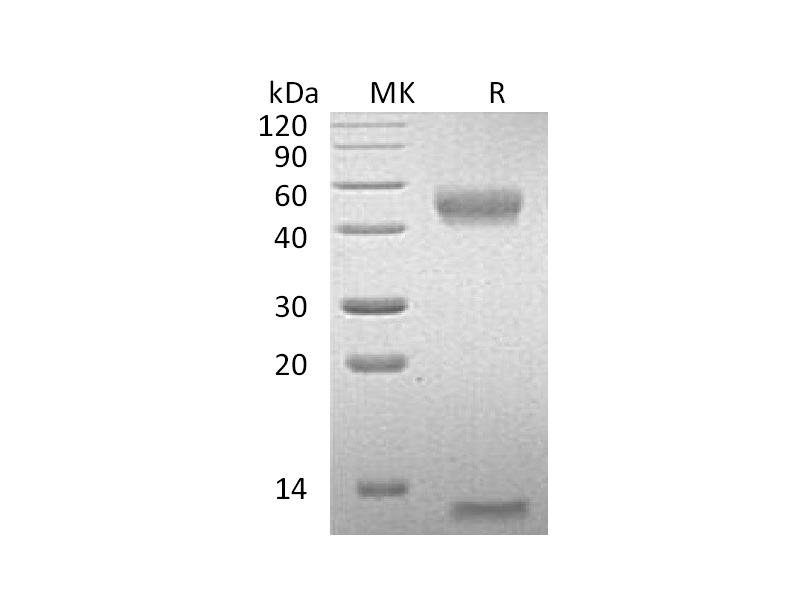 Recombinant Mouse FcRn Heterodimer (C-6His)
