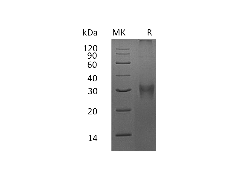 Recombinant Mouse Asprosin (N-8His)