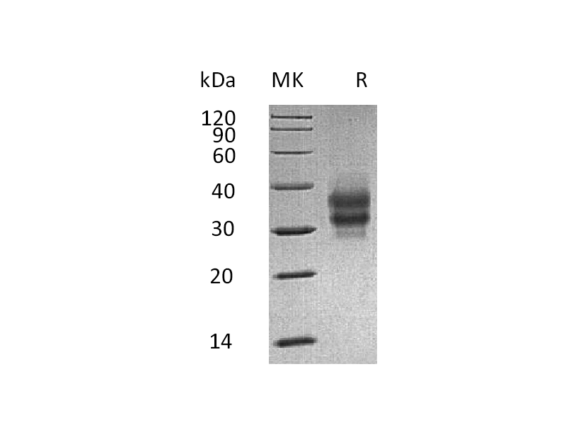 Recombinant Mouse FOLR1 (C-6His)