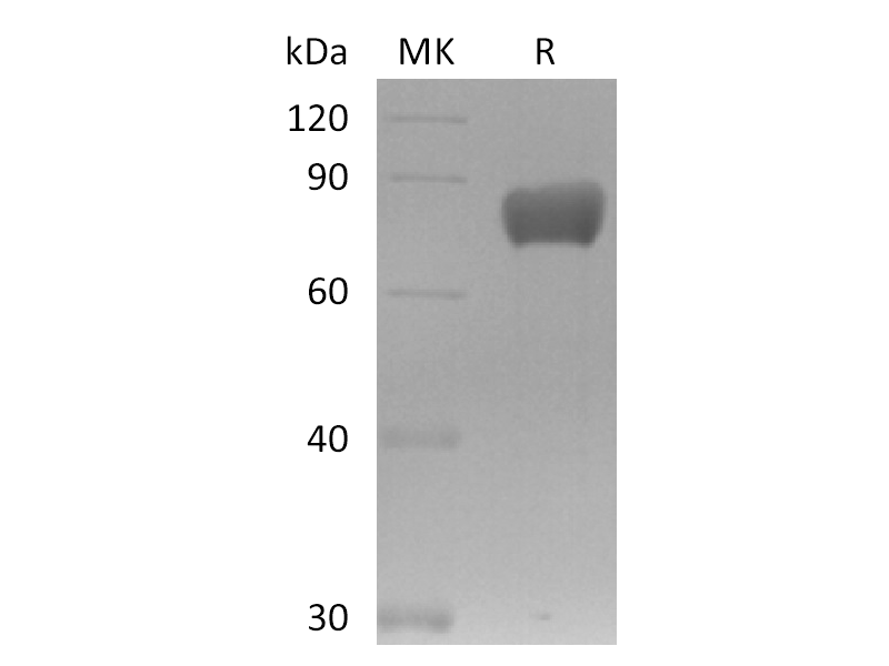 Recombinant Mouse FSTL1 (C-Fc)