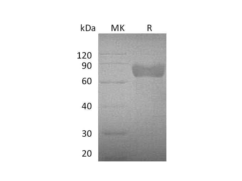 Recombinant Mouse GHR (C-Fc)