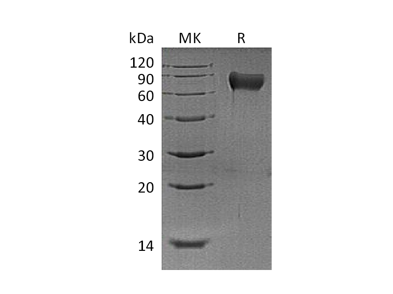 Recombinant Mouse Hemopexin (C-6His)