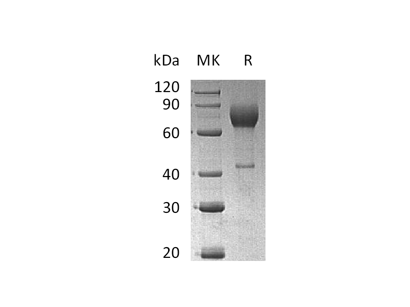 Recombinant Mouse IL-2RA (C-Fc)