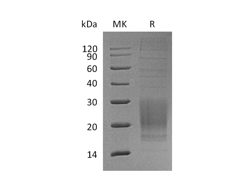 Recombinant Mouse ICOS (C-6His)