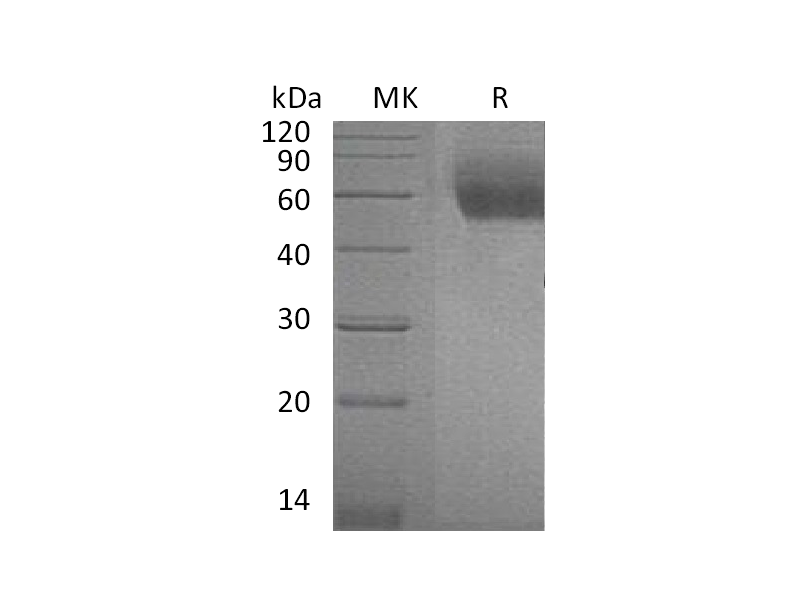 Recombinant Mouse ST2 (C-6His)