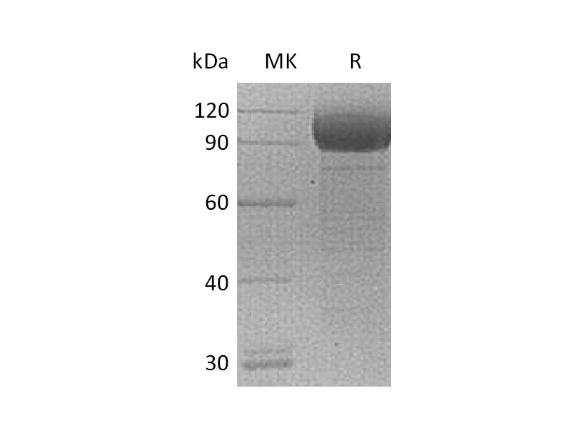 Recombinant Mouse ST2 (V192A, C-Fc)