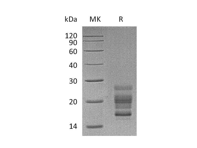 Recombinant Mouse IL-17A (C-6His)