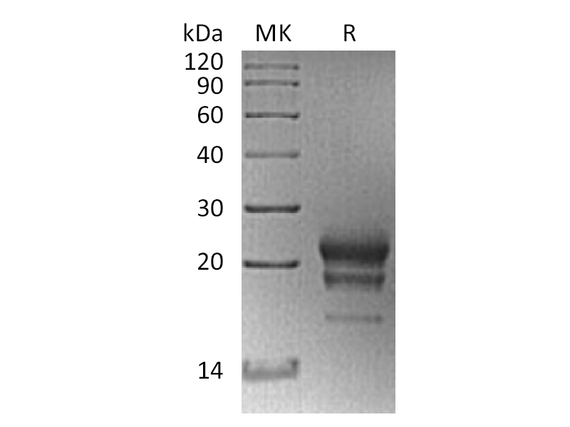 Recombinant Mouse IL-17F (C-6His)