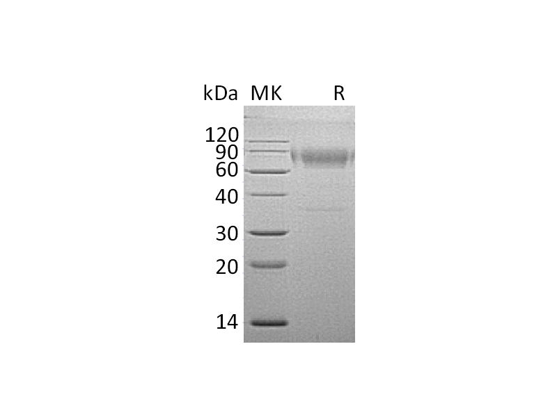 Recombinant Mouse IL-18BPd (C-Fc)
