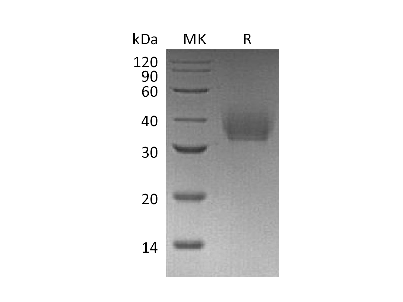 Recombinant Mouse IL-21R (C-6His)