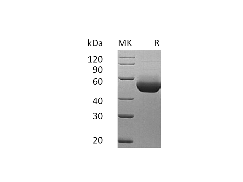 Recombinant Mouse IL-5RA (C-6His)