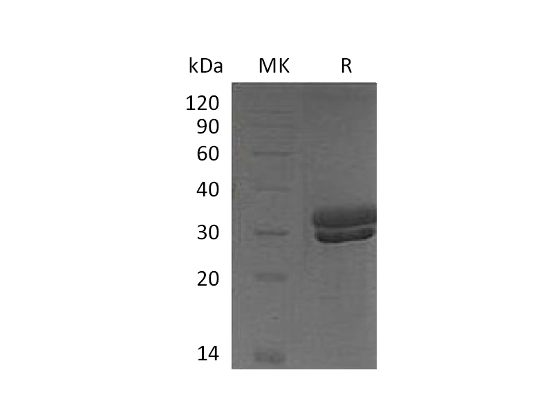 Recombinant Mouse KLK7 (C-6His)