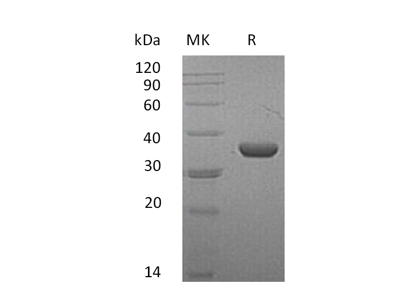 Recombinant Mouse LDHA (C-6His)