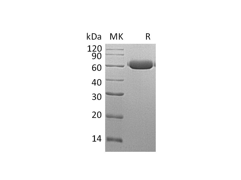 Recombinant Mouse Legumain (C-6His)