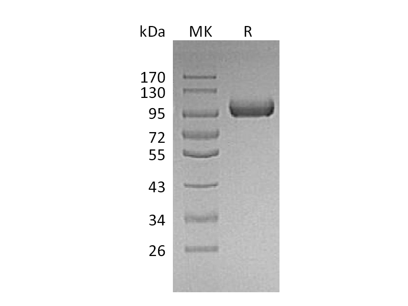 Recombinant Mouse LRIG1 (C-6His)