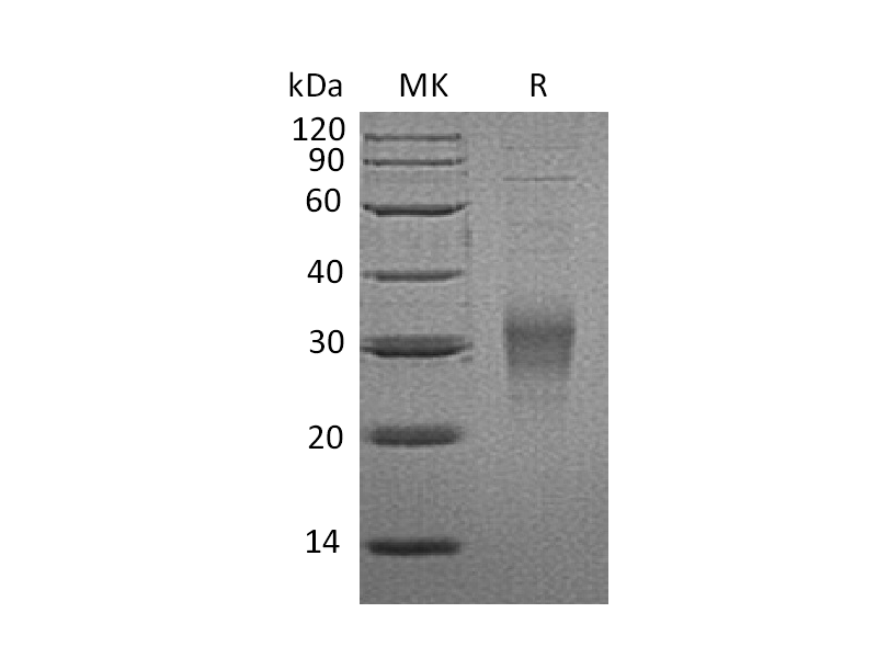 Recombinant Mouse FcgR4 (C-6His)