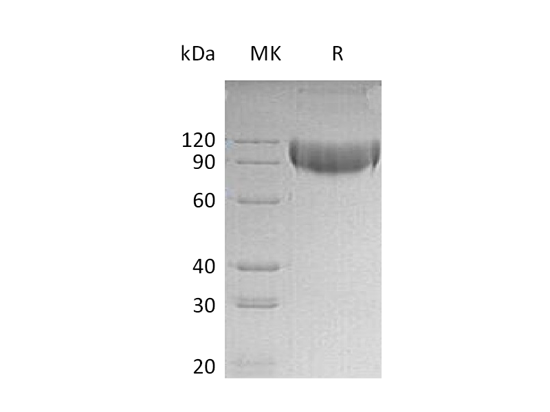 Recombinant Mouse L-selectin (C-6His)