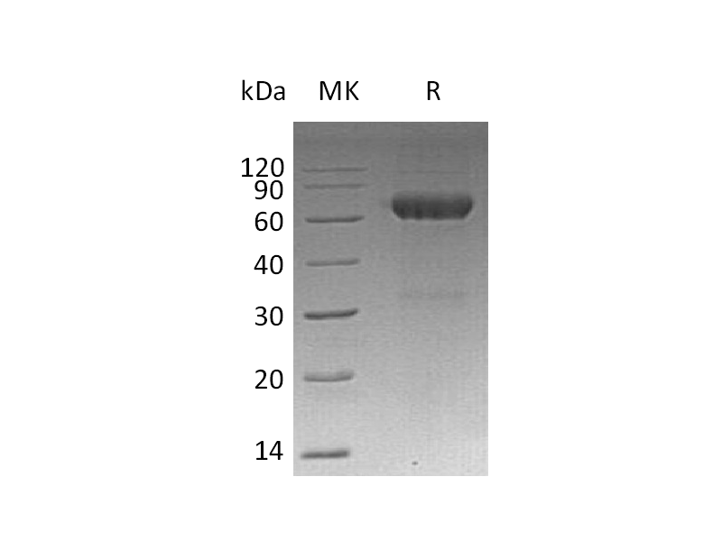 Recombinant Mouse MMP-12 (C-6His)