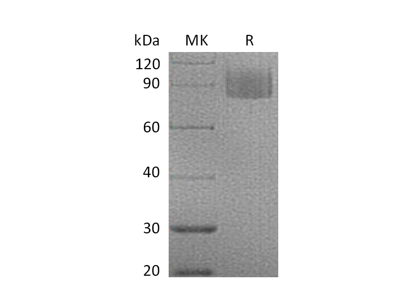 Recombinant Mouse MAG (C-6His)