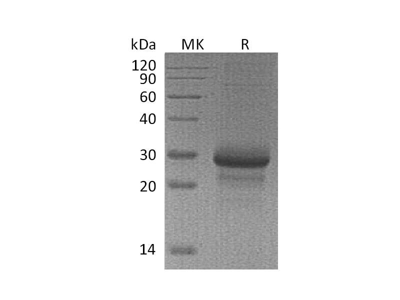 Recombinant Mouse MBL-2