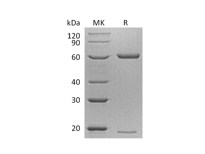 Recombinant Mouse PCSK9 (C-6His)