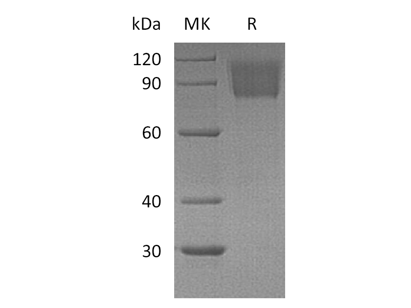 Recombinant Mouse PDGFRA (C-6His)