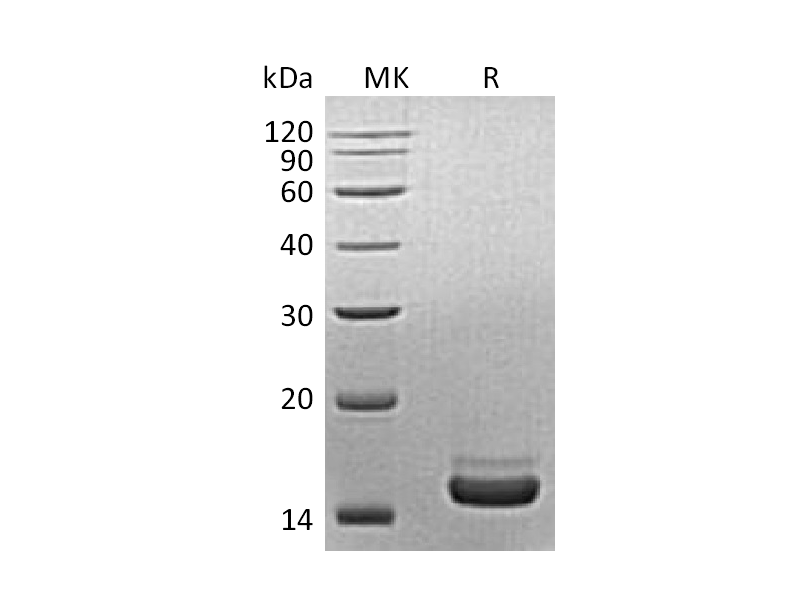 Recombinant Mouse PLA2G1B (C-6His)