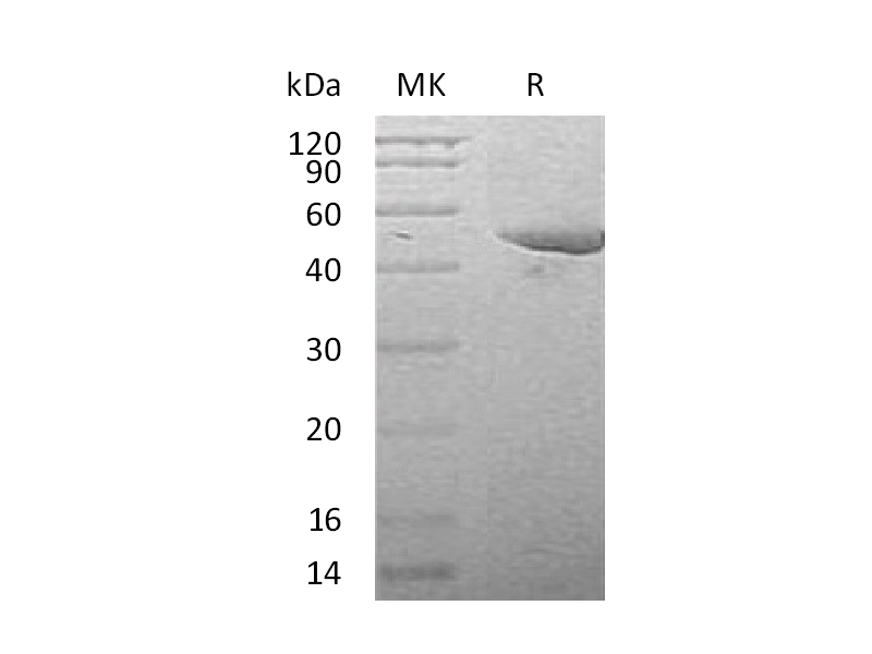 Recombinant Mouse Serpin E1 (C-6His)