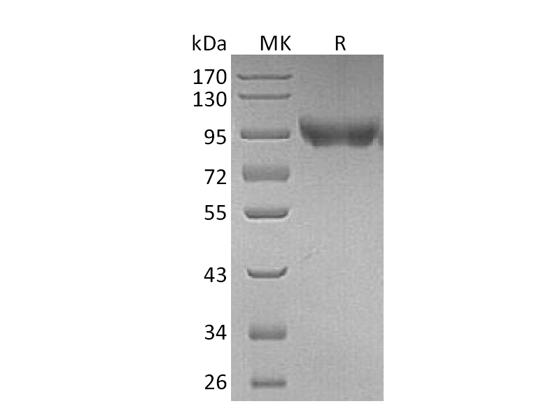 Recombinant Mouse CD31 (C-6His)